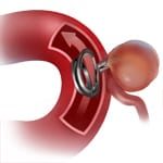 Cerebrovascular Topics